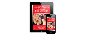 Fitzpatrick's Color Atlas And Synopsis Of Clinical Dermatology, Eighth Edition